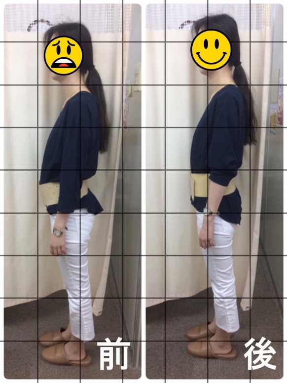 20代女性